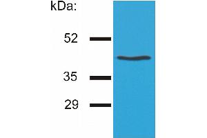 Western blotting analysis of HLA-G by the antibody MEM-G/4 on HLA-G1 transfectants (LCL-HLA-G1). (HLAG Antikörper)