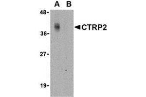 Western Blotting (WB) image for anti-C1q and Tumor Necrosis Factor Related Protein 2 (C1QTNF2) (N-Term) antibody (ABIN1031331) (C1QTNF2 Antikörper  (N-Term))