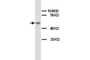 Western Blot analysis of CHRNA1 expression from rat skeletal muscle lyate with CHRNA1 polyclonal antibody .