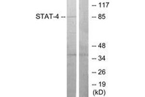 Western blot analysis of extracts from HeLa cells, using STAT4 (Ab-693) Antibody. (STAT4 Antikörper  (AA 660-709))