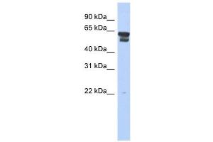 BLMH antibody used at 1 ug/ml to detect target protein.