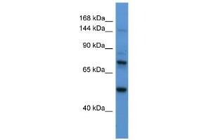WB Suggested Anti-ASTN2 Antibody Titration:  0. (Astrotactin 2 Antikörper  (N-Term))