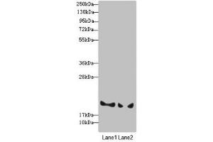 Western blot All lanes: BLOC1S6 antibody at 3. (Pallidin Antikörper  (AA 1-170))