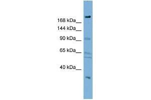 WB Suggested Anti-DIP2A Antibody Titration:  0. (DIP2A Antikörper  (N-Term))