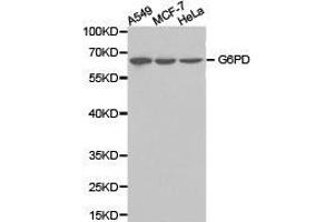 Western Blotting (WB) image for anti-Glucose-6-Phosphate Dehydrogenase (G6PD) antibody (ABIN1872757) (Glucose-6-Phosphate Dehydrogenase Antikörper)
