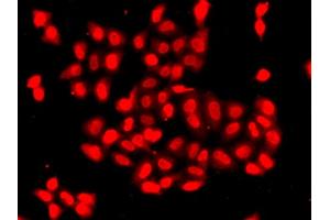 Immunofluorescence analysis of A549 cells using CAMK1D antibody (ABIN5975586). (CAMK1D Antikörper)