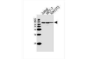 Lane 1: Jurkat Cell lysates, Lane 2: MCF-7 Cell lysates, Lane 3: NIH/3T3 Cell lysates, probed with RPS6KB2 (164CT21. (RPS6KB2 Antikörper)