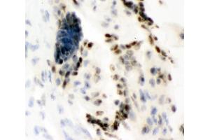 IHC analysis of Ku80 using anti-Ku80 antibody (ABIN3043964).