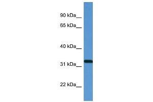 Western Blot showing ZAP70 antibody used at a concentration of 1 ug/ml against Fetal Lung Lysate (ZAP70 Antikörper  (N-Term))