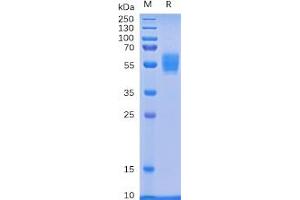 Human NKG2D Protein, mFc Tag on SDS-PAGE under reducing condition. (KLRK1 Protein (mFc Tag))