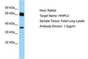 Image no. 1 for anti-HHIP-Like 2 (HHIPL2) (AA 606-655) antibody (ABIN6750191) (HHIPL2 Antikörper  (AA 606-655))