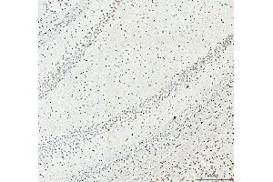 IHC analysis of SFPQ using anti-SFPQ antibody (ABIN7603089). (SFPQ Antikörper  (Middle Region))