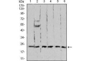 Western blot analysis using RAN mouse mAb against A431 (1), C6 (2), Jurkat (3), Hela (4), COS7 (5), and Jurkat (6) cell lysate. (RAN Antikörper  (AA 1-216))