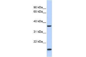 WB Suggested Anti-ZIC4 Antibody Titration:  0. (ZIC4 Antikörper  (N-Term))