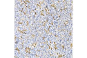 Immunohistochemistry of paraffin-embedded mouse kidney using TOM20 Rabbit mAb (ABIN7268554) at dilution of 1:100 (40x lens).