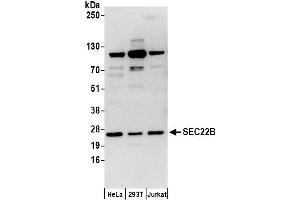 Western Blotting (WB) image for anti-SEC22b Vesicle Trafficking Protein (SEC22B) (AA 100-150) antibody (ABIN7451024)