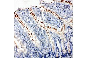 Anti-Zonula occludens protein 3 antibody, IHC(P) IHC(P): Rat Intestine Tissue (TJP3 Antikörper  (C-Term))