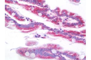 Anti-SCNN1B / ENaC Beta antibody IHC staining of human intestine. (SCNN1B Antikörper  (AA 306-332))