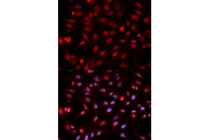 Immunofluorescence analysis of HeLa cells using APEX1 antibody. (APEX1 Antikörper)