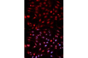 Immunofluorescence analysis of HeLa cells using APEX1 antibody. (APEX1 Antikörper)