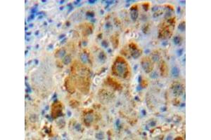 Used in DAB staining on fromalin fixed paraffin- embedded liver tissue (IL-11 Antikörper  (AA 22-199))