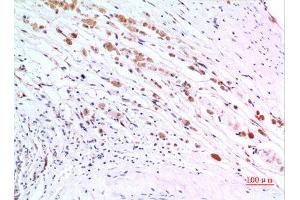 Immunohistochemistry (IHC) analysis of paraffin-embedded Human Brain, antibody was diluted at 1:100. (ZKSCAN4 Antikörper  (Internal Region))