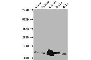 Western Blot Positive WB detected in: Mouse Liver tissue, Mouse Spleen tissue, Mouse kidney tissue, Mouse Brain tissue, Hela whole cell lysate All lanes: Mif antibody at 1:2000 Secondary Goat polyclonal to rabbit IgG at 1/50000 dilution Predicted band size: 13 kDa Observed band size: 13 kDa (MIF Antikörper  (AA 2-115))
