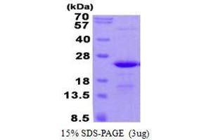 Image no. 1 for Chromosome 17 Open Reading Frame 49 (C17orf49) protein (His tag) (ABIN1098372)