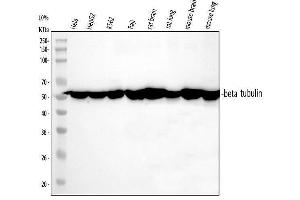 Western blot analysis of Tubulin beta using anti-Tubulin beta antibody (ABIN7602744). (TUBB Antikörper  (C-Term))