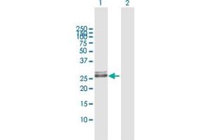 Western Blotting (WB) image for anti-Major Histocompatibility Complex, Class II, DR beta 1 (HLA-DRB1) (AA 1-266) antibody (ABIN516510)