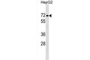 Western Blotting (WB) image for anti-Protein Phosphatase 1, Regulatory Subunit 16B (PPP1R16B) antibody (ABIN2999569) (PPP1R16B Antikörper)