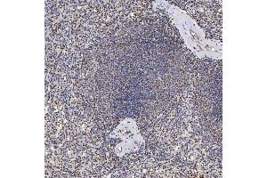 IHC analysis of U1A/SNRPA using anti-U1A/SNRPA antibody (ABIN7600891). (SNRPA1 Antikörper  (AA 25-218))