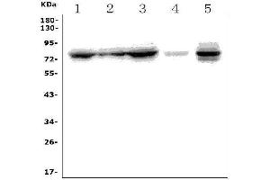 Western blot analysis of MTA2 using anti-MTA2 antibody (ABIN7599519).
