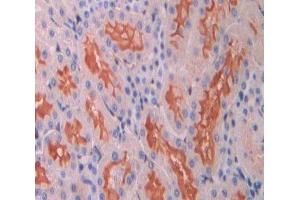 Used in DAB staining on fromalin fixed paraffin- embedded Kidney tissue