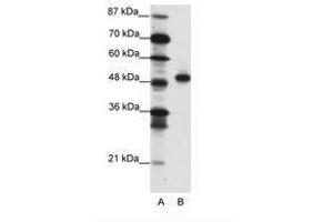 Image no. 1 for anti-Mesenchyme Homeobox 2 (MEOX2) (C-Term) antibody (ABIN202201) (MEOX2 Antikörper  (C-Term))