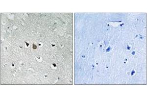 Immunohistochemistry analysis of paraffin-embedded human brain tissue, using C-RAF (Ab-269) Antibody. (RAF1 Antikörper  (AA 231-280))