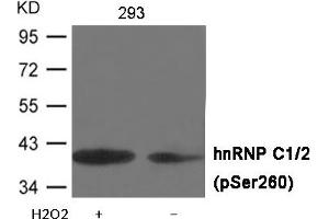 Western blot analysis of extracts from 293 cells untreated or treated with H2O2 using hnRNP C1/2 (Phospho-Ser260) Antibody . (HNRNPC Antikörper  (pSer260))