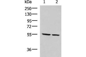 Western blot analysis of LOVO and LO2 cell lysates using ECM1 Polyclonal Antibody at dilution of 1:650 (ECM1 Antikörper)