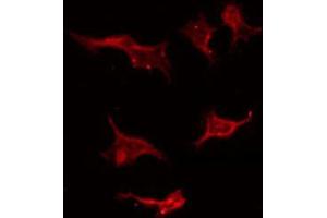 ABIN6267405 staining Hela by IF/ICC. (Stathmin 1 Antikörper  (pSer25))