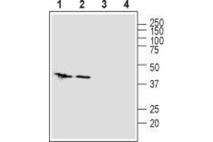 Western Blotting (WB) image for anti-Solute Carrier Family 39 (Zinc Transporter), Member 1 (SLC39A1) (AA 5-20), (Extracellular) antibody (ABIN7043723)