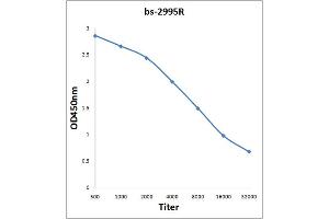 Antigen: 0. (Msk1/2 (AA 49-94) Antikörper)