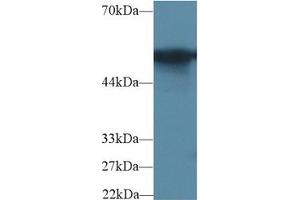 Western blot analysis of Rat Colon lysate, using Rat G6PD Antibody (2 µg/ml) and HRP-conjugated Goat Anti-Rabbit antibody ( (Glucose-6-Phosphate Dehydrogenase Antikörper  (AA 1-515))
