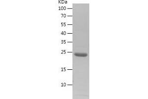 Western Blotting (WB) image for Jun Proto-Oncogene (JUN) (AA 75-274) protein (His tag) (ABIN7123652)