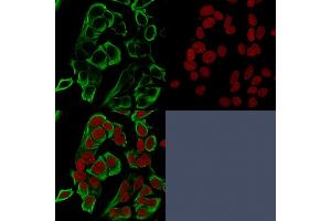 Confocal immunofluorescence analysis of MCF-7 cells using EpCAM Mouse Recombinant Monoclonal Antibody (rMOC-31) labeled in Green. (Rekombinanter EpCAM Antikörper)
