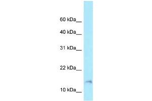 WB Suggested Anti-BAD Antibody Titration: 1. (BAD Antikörper  (Middle Region))