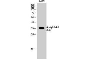 Western Blotting (WB) image for anti-Apurinic/Apyrimidinic Endonuclease 1 (APEX1) (acLys6) antibody (ABIN3181880) (APEX1 Antikörper  (acLys6))