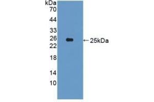 Detection of Recombinant CDCP1, Human using Polyclonal Antibody to CUB Domain Containing Protein 1 (CDCP1)