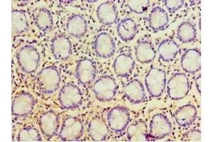 Immunohistochemistry of paraffin-embedded human colon tissue using ABIN7168119 at dilution of 1:100 (POP7 Antikörper  (AA 1-140))