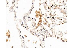 Immunohistochemistry analysis of paraffin-embedded human lung using CXCR7 Polyclonal Antibody at dilution of 1:100.