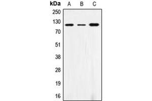 Western blot analysis of CD172a expression in THP1 (A), AML193 (B), HL60 (C) whole cell lysates. (SIRPA Antikörper  (C-Term))
